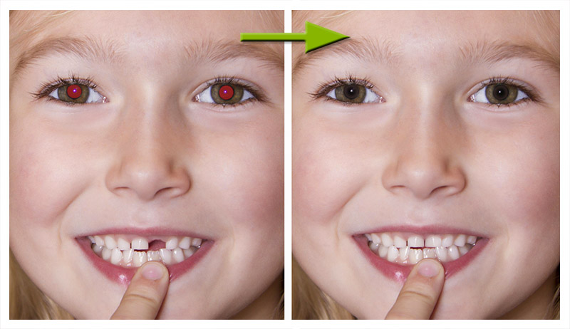 کارکرد فلاش 22